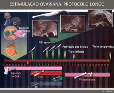 Tratamentos - Estimulação Ovariana