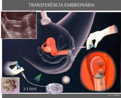 Tratamentos - Transferência de Embriones